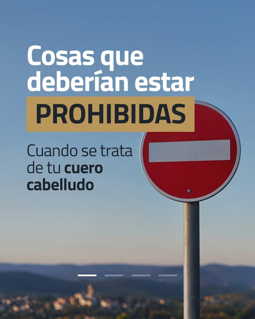 Hay cosas que deberían estar prohibidas cuando se trata de tu pelo: esconder la calvicie, posponer u