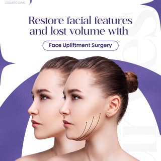 Our advanced Face Upliftment Surgery doesn't just turn back time, it restores what time has taken: n