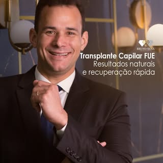 O Transplante Capilar FUE é um procedimento moderno e minimamente invasivo capaz de transformar sua 
