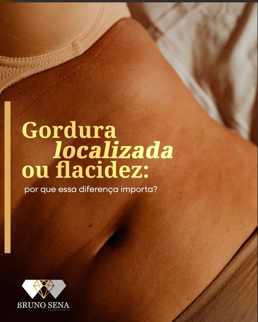 Nem sempre aquilo que percebemos como “gordura localizada” tem uma única causa.

Excesso de pele, fl