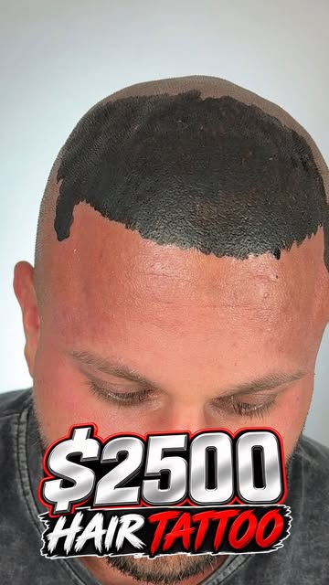 Results after 3 SMP sessions! 🔥

My client previously had a hair transplant but didn’t get the full