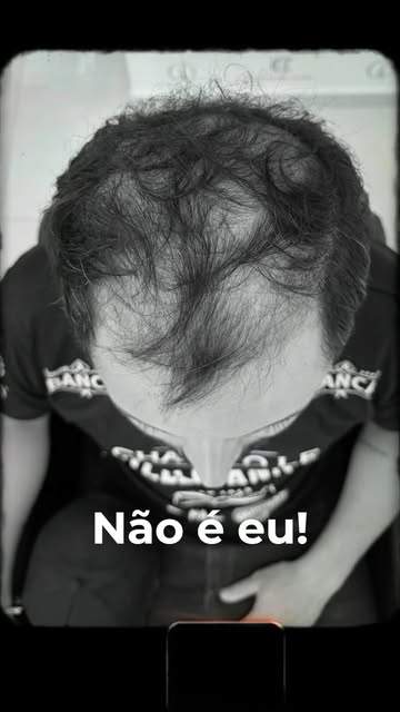 Mais do que cabelo, uma transformação na autoestima. ✨

O Leandro confiou no processo — e hoje o res