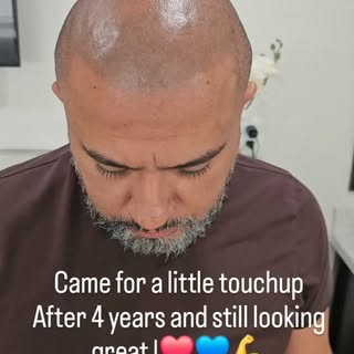 TOUCHUP TIME 
STILL LOOKING GREAT AFTER 4 YEARS !!🔥💪
GET YOU HAIRLINE BACK BY THE BEST SMP ARTIST 