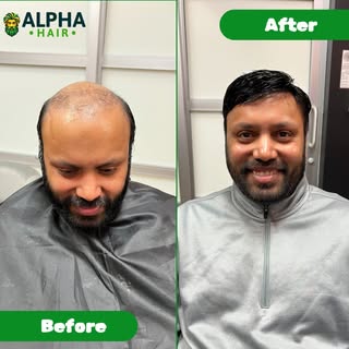 Be inspired by Arjun's remarkable hair transformation showcased in these compelling before and after