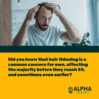 Hair thinning affects about 85% of men before they hit 50, with some noticing it even before 21! Rec