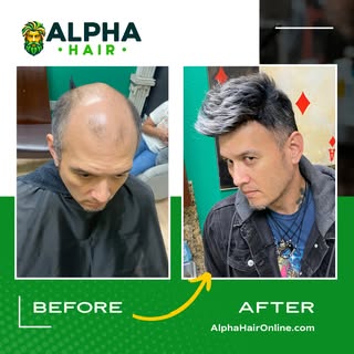 Dreaming of fuller hair? Let's make it a reality! Discover the joy of thick, healthy locks and open 