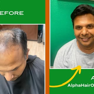 Why Alpha Hair? We pride ourselves on providing a solution that not only addresses hair loss but als