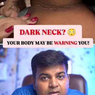 🖤 Think It’s Dirt? Look Again.

That dark, thick, velvety skin on your neck, underarms or knuckles 
