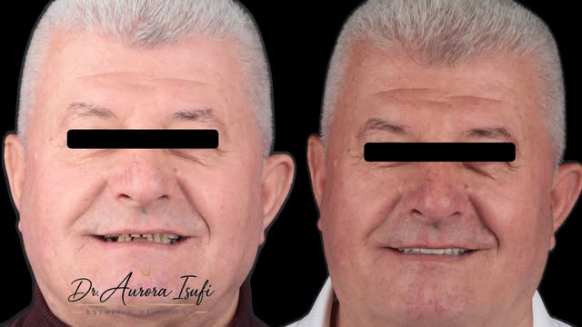 Një transformim i kujdesshëm, me fokus në funksion, estetikë, harmoni dhe natyralitet. ✨ Rezultati: 