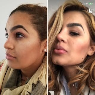 Harmonização facial

É perfeitamente normal desejarmos algumas mudanças em nossa aparência. Seja na 