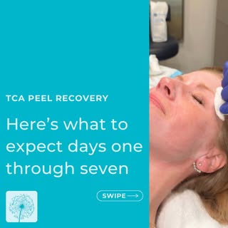 TCA Peel Recovery: What to Expect Day by Day ➡️

Thinking about a TCA peel but wondering what the he
