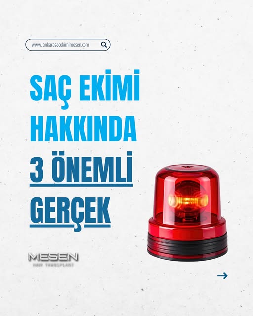🚨 SAÇ EKİMİNDE BU 3 HATADAN BİRİNİ YAPMA

Binlerce kişi pişman oldu. Sen olma. 👆

---

**❌ ICE Gre