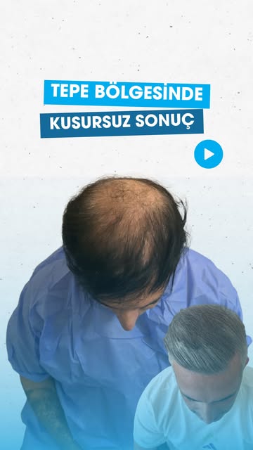 "Tepe bölgesi tutmaz." 

Bu cümleyi çok duyduk. Ve çoğu zaman haklı çıkan taraf, 
maalesef yanlış ya