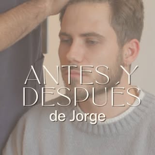 ⏳ Un año después… ¡Así está Jorge!

Hace un año, Jorge confió en el @dr.pilo_ y en el equipo de Zere