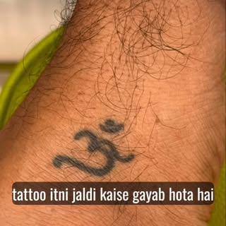 Laser Tattoo Removal in Gorakhpur | सुरक्षित एवं Professional Tattoo Removal

क्या आप अपने पुराने या