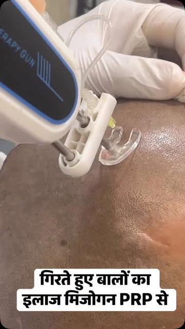 **क्या आप भी बाल झड़ने या पतले होने की समस्या से परेशान हैं? 💆‍♂️✨**

अब पाइए झड़ते बालों से राहत और 