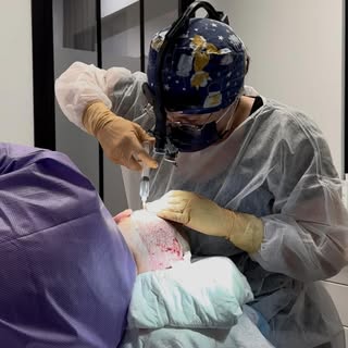 Deux étapes clés pour une greffe capillaire réussie !

➰ 1. Prélèvement des greffons
C’est la premiè