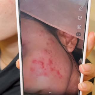 The glow up is unmatched 🙂‍↕️

We absolutely love the glow after skin boosters (watch till the end!
