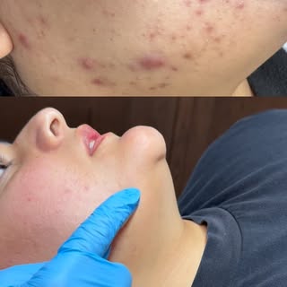 She already loves her skin… and we’re not even done yet. 👀😎