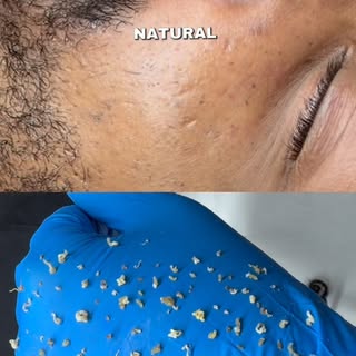 The best reviews aren’t written… they’re spoken.

Hearing a client say their skin has never looked t