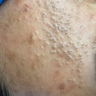 One session won’t erase years of skin concerns… but it can change the direction of your skin.

This 