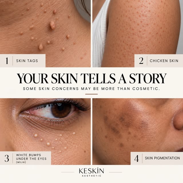Your Skin Is a Mirror of Your Body! 

Changes in your skin may not simply be a superficial cosmetic 