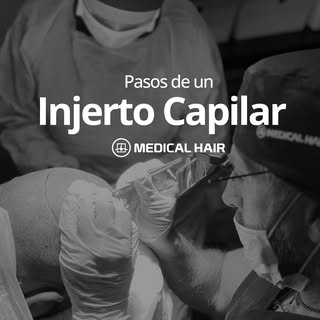 ¿ Quieres saber cómo es  el proceso completo de un injerto capilar en Medical Hair Madrid? 

En este