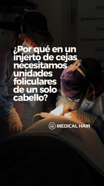 En el cuero cabelludo, una unidad folicular puede tener 1, 2, 3 o incluso más cabellos.

Pero en la 