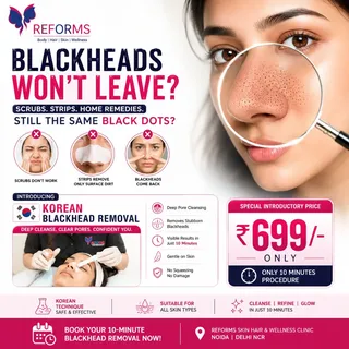 Your Nose Doesn't Need a Filter. It Needs This.

Blackheads don't disappear with scrubs or nose stri