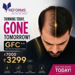 GFC++ Hair Regrowth Caption

Hair thinning? Receding hairline? Excessive hair fall? It’s time to giv