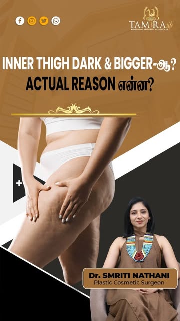 Inner Thighs Dark & Bigger? What’s the Actual Reason?

Darkness and increased size around the inner 