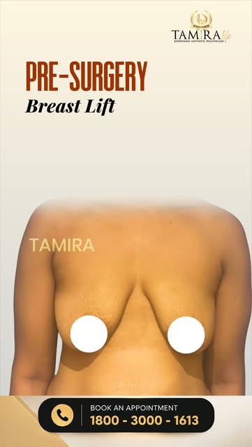 Thinking About a Breast Lift? What to Expect Before & After

Considering a Breast Lift but not sure 
