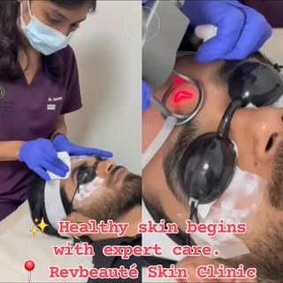 ✨ Healthy skin begins with expert care.
📍 Revbeauté Skin Clinic
📞 8220063473