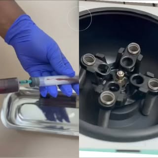 Restore Stronger, Healthier Hair Naturally