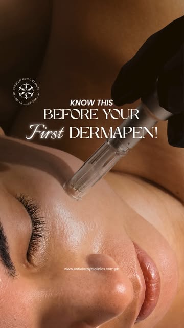 Got questions about Dermapen for pigmentation and scarring? 🤔✨
Dr. Huma answers your most frequentl