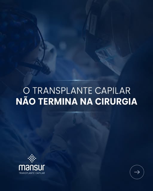 Cuidados no Pós-Operatório de Transplante Capilar: O Que Você Precisa Saber?

O transplante capilar 