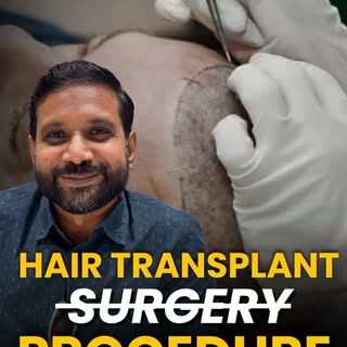 ✨ It’s Not a Surgery… It’s a Hair Restoration Procedure ✨

Many people hesitate when they hear the w