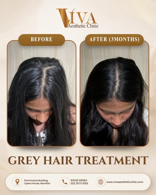 Grey hair doesn’t always have to be something you simply accept.✨

It may be time to look beyond tem