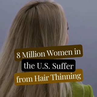 Hair thinning isn’t just about looks—it’s about how you feel when you look in the mirror. At Vita’s 