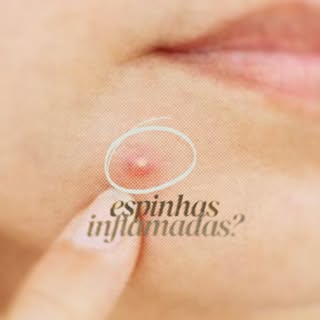 Você também sente aquela dor na pele antes da espinha aparecer?

Isso pode ser um sinal de que a inf