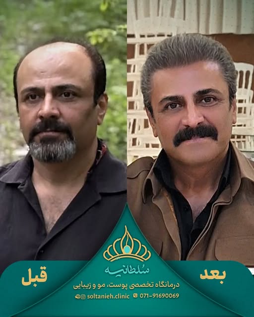 این فقط تغییر موها نیست… 👀✨

چهره‌اش جوون‌تر شده، لبخندش بیشتر شده و حالا موهایی داره که واقعاً بهش