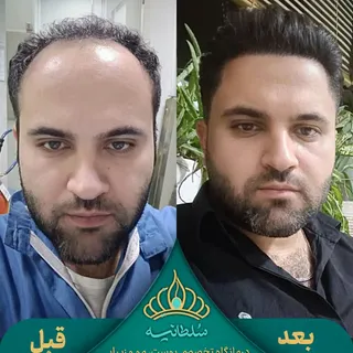 گاهی یک تغییر در موها، فقط تغییر در مو نیست؛ می‌تونه فرم چهره، استایل و حتی حس آدم نسبت به خودش رو ت