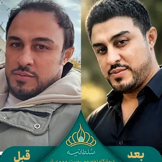 قبل و بعد رو ببینید؛
گاهی یک تغییر درست، فقط موها رو برنمی‌گردونه، بلکه فرم و حال‌وهوای چهره رو هم ت