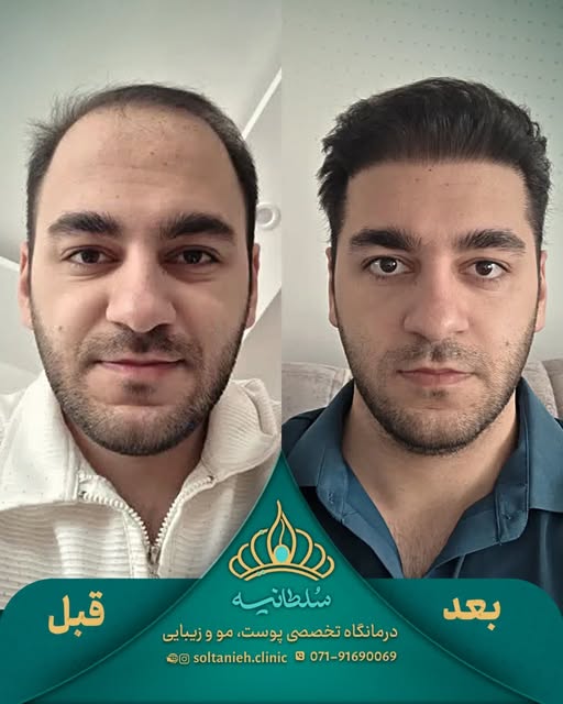 گاهی برای تغییر ظاهر، لازم نیست چهره عوض بشه؛
کافیه قاب صورت دوباره درست شکل بگیره. ✨
در این نمونه‌ک