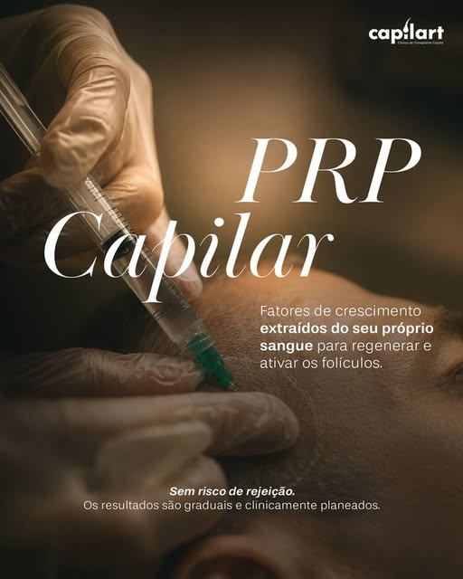 A ideia do PRP é simples: utilizar o potencial regenerativo do seu próprio organismo para estimular 