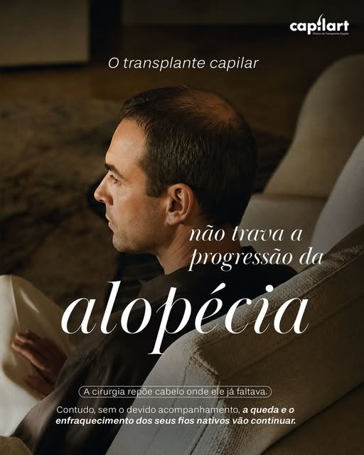 O transplante capilar pode recuperar zonas onde o cabelo já se perdeu, mas não impede que os fios na