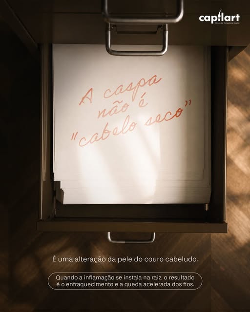 A caspa não é apenas uma questão estética nem significa simplesmente que o couro cabeludo está “seco