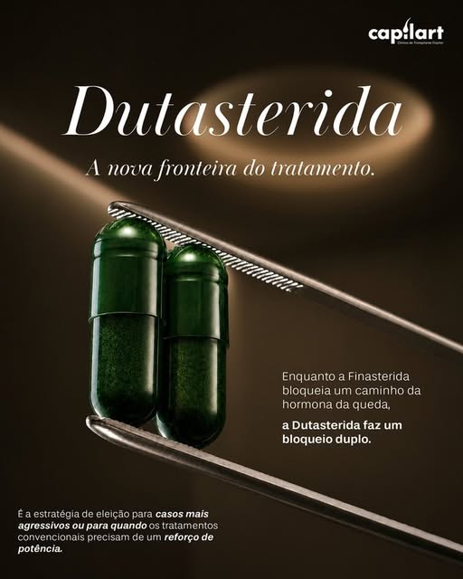A Dutasterida é uma das opções utilizadas no tratamento da alopecia androgenética, atuando na reduçã