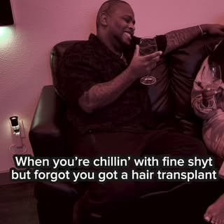 Sometimes your vibin and forgot the back of your head still on medium rare lol 😂 #hairtransplant #v