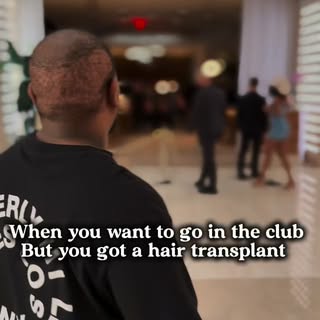 Dress code said no transplants allowed 😒 #vegasbarber #scalpmicropigmentation #fuegosmp #hendersonb